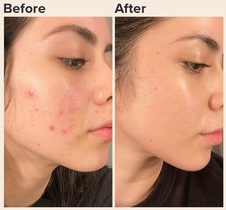 Bitkisel Peeling Yosun Peeling Antalya